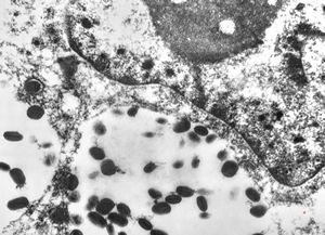 F, 24y. | molluscum contagiosum